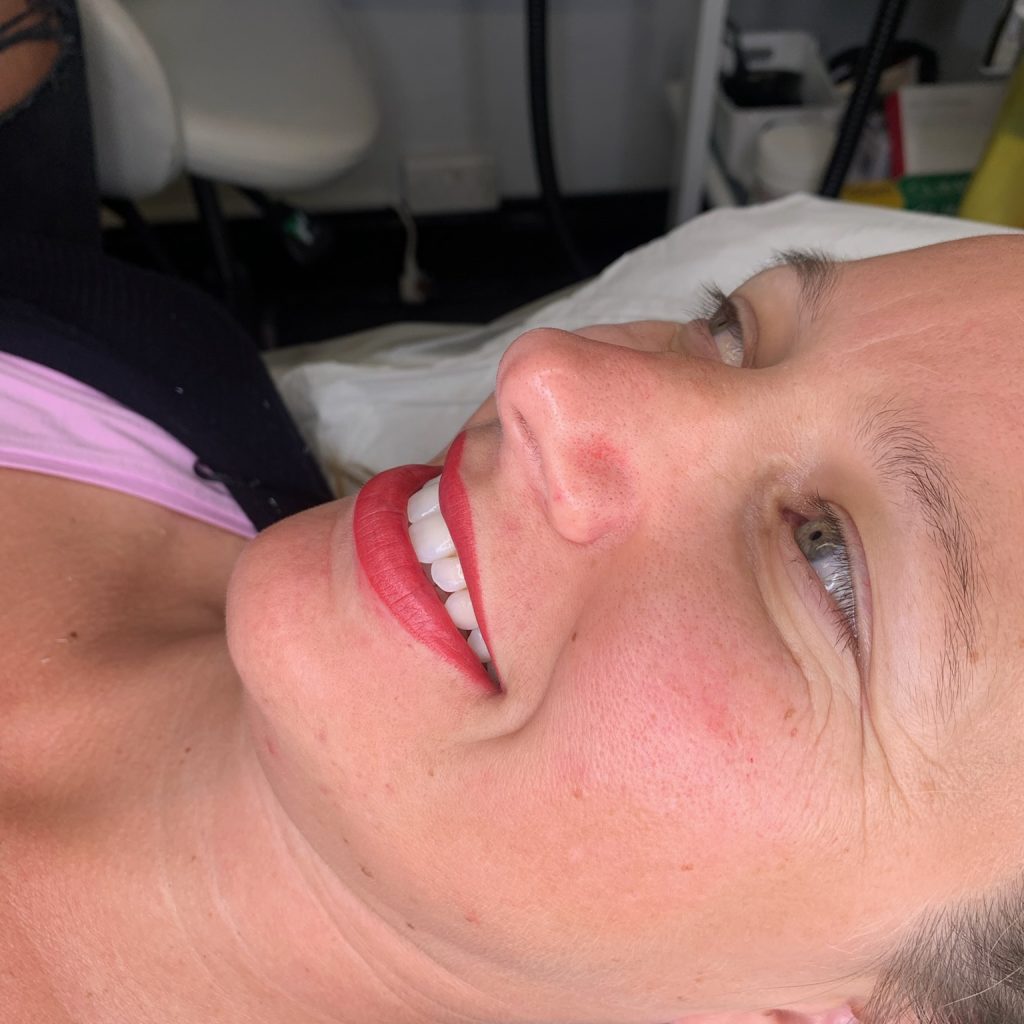Lip Micropigmentation Lip Micropigmentation